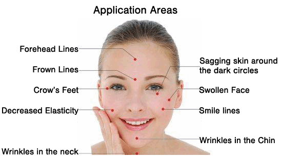 facial-acupuncture